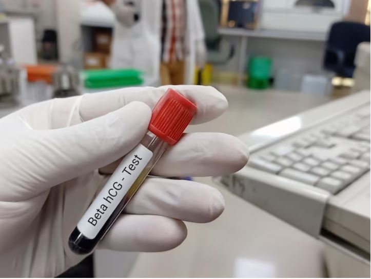 beta hcg test